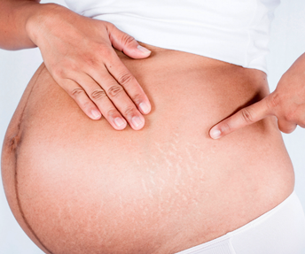 Common Skin Conditions While Pregnant