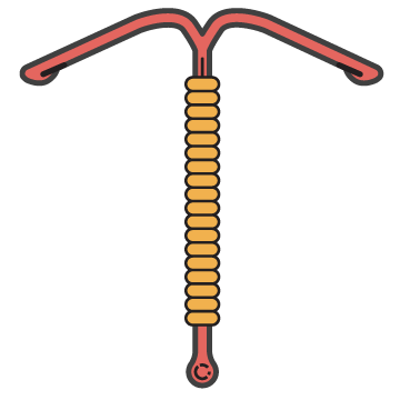 IUD Shape Illustration